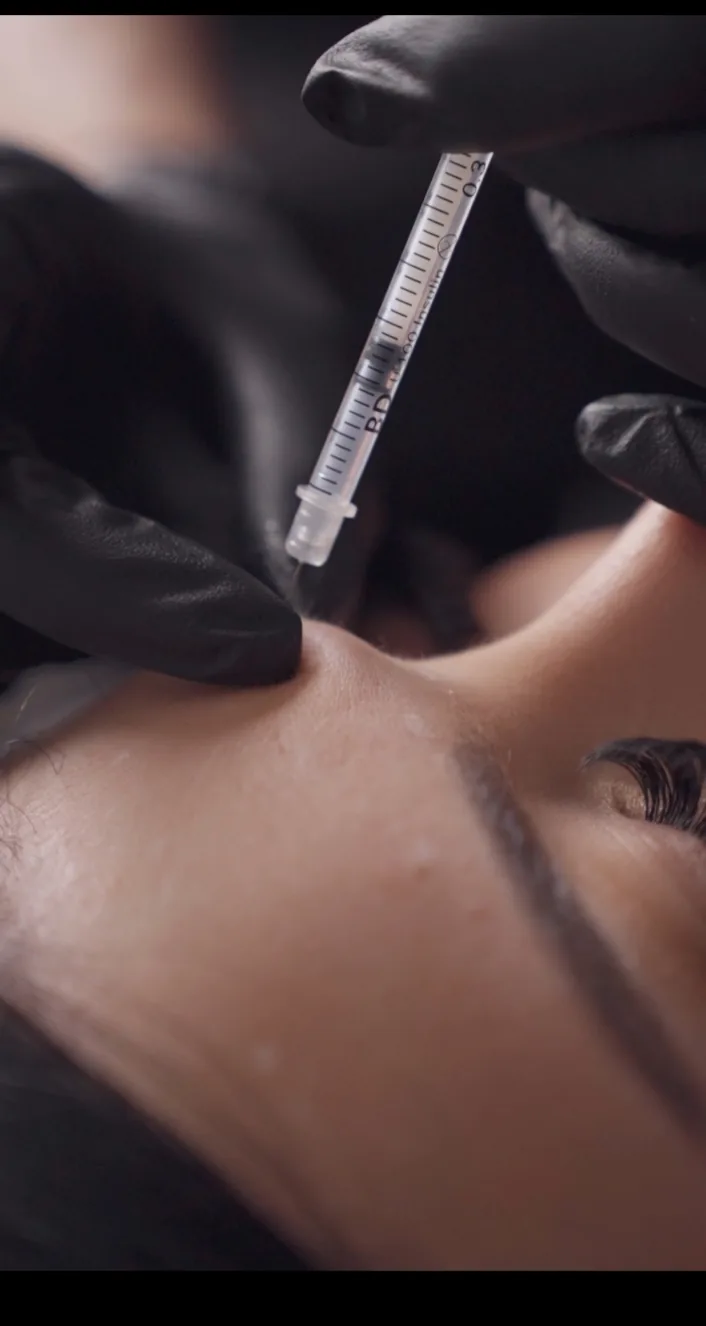 Close-up view of syringe during a cosmetic injectable treatment