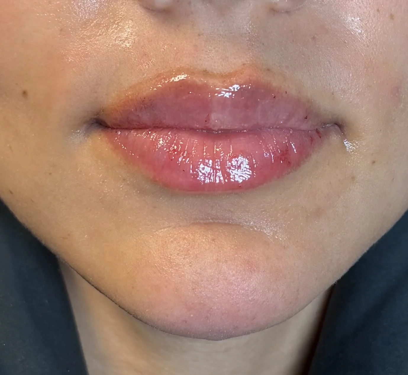 Front view of lips in Entyre editorial photography